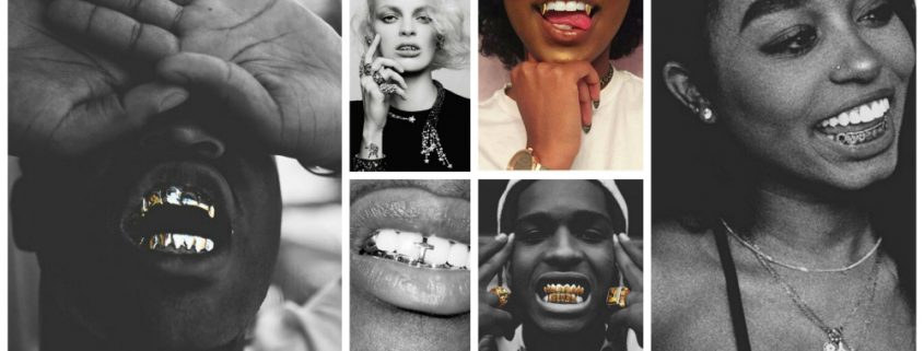 gold grillz