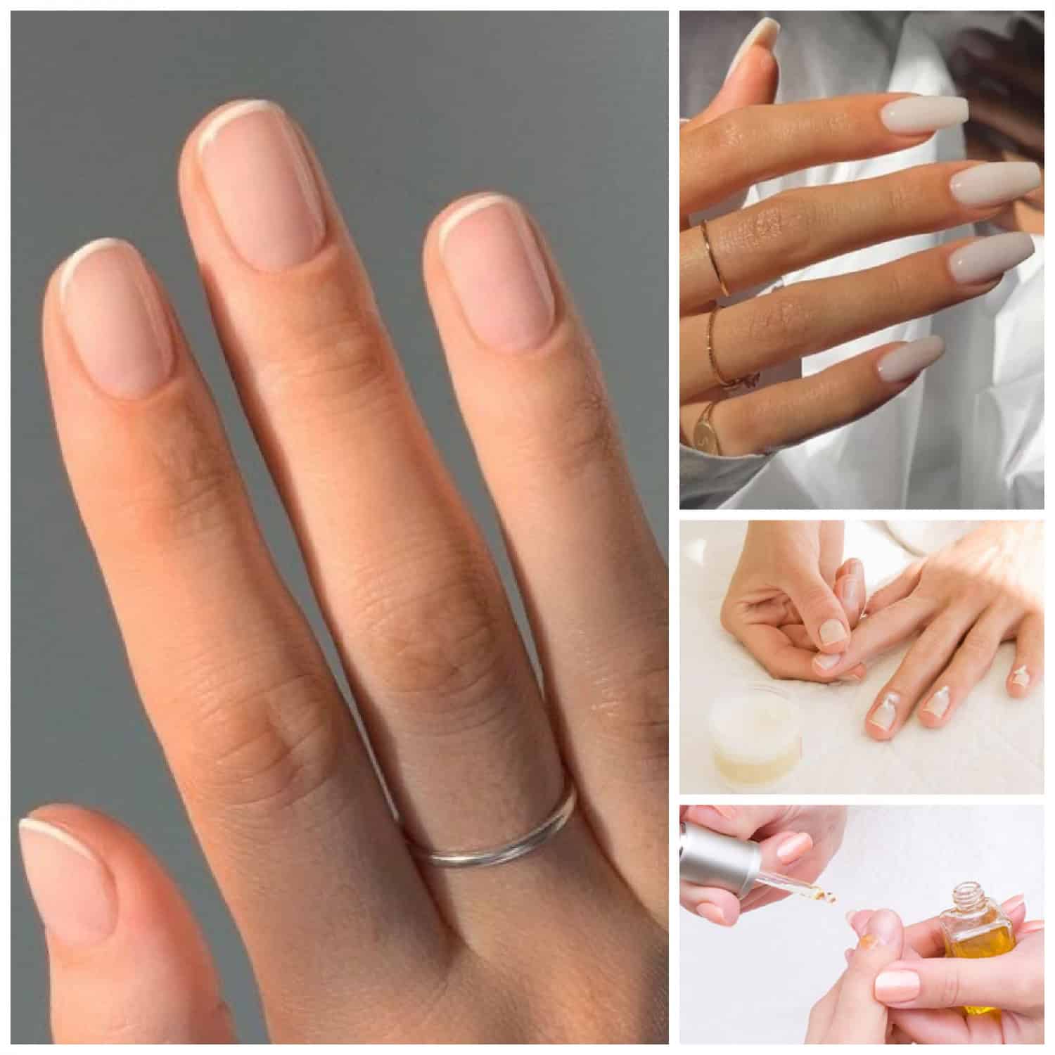 What Causes Brittle Nails and What Solutions are Available?