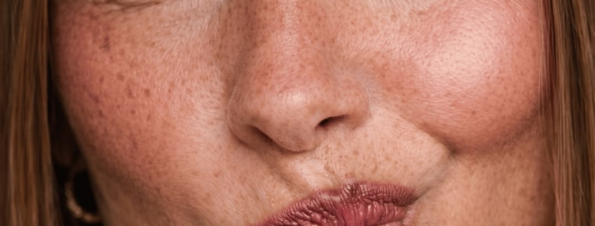 skincare peptides