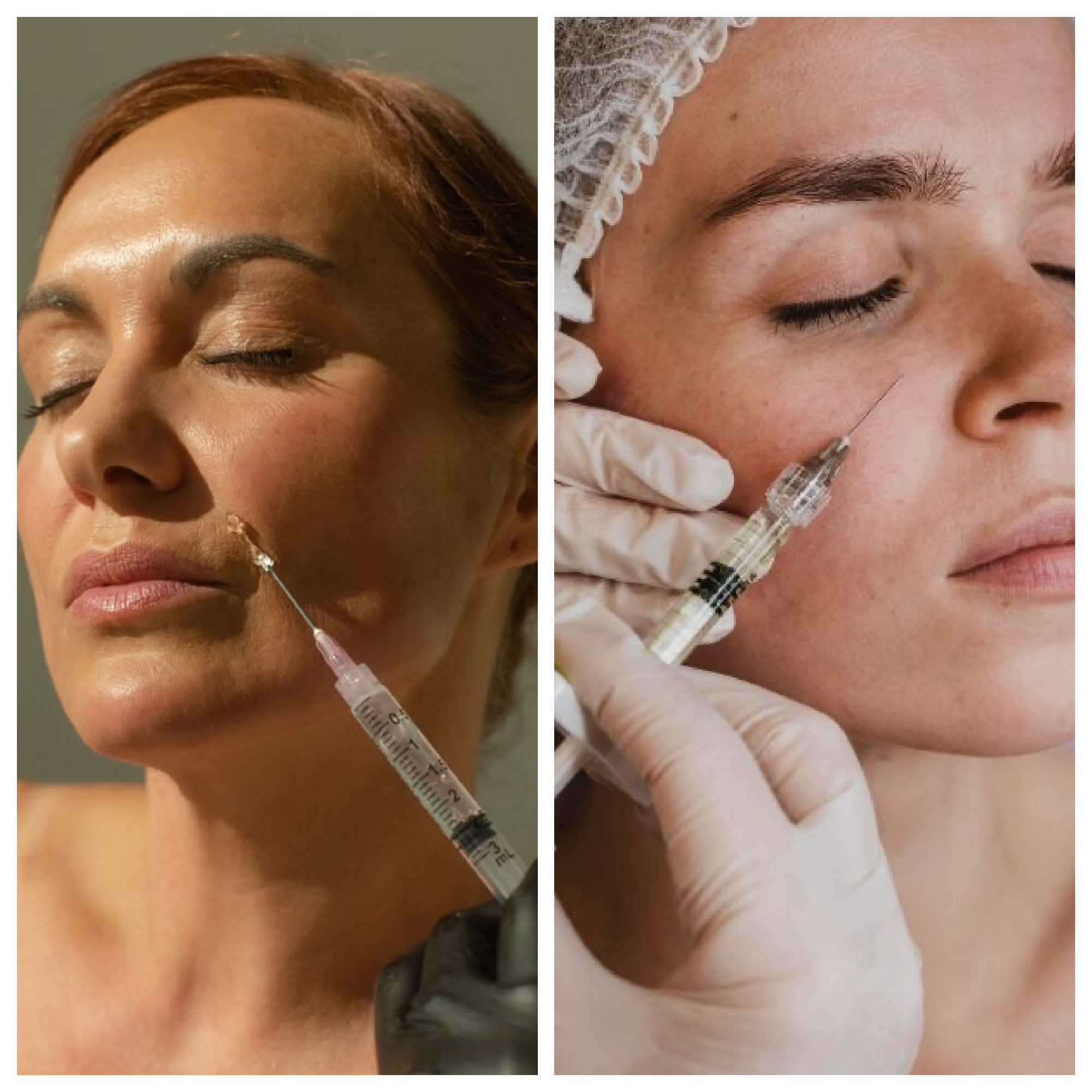 skin laxity procedures