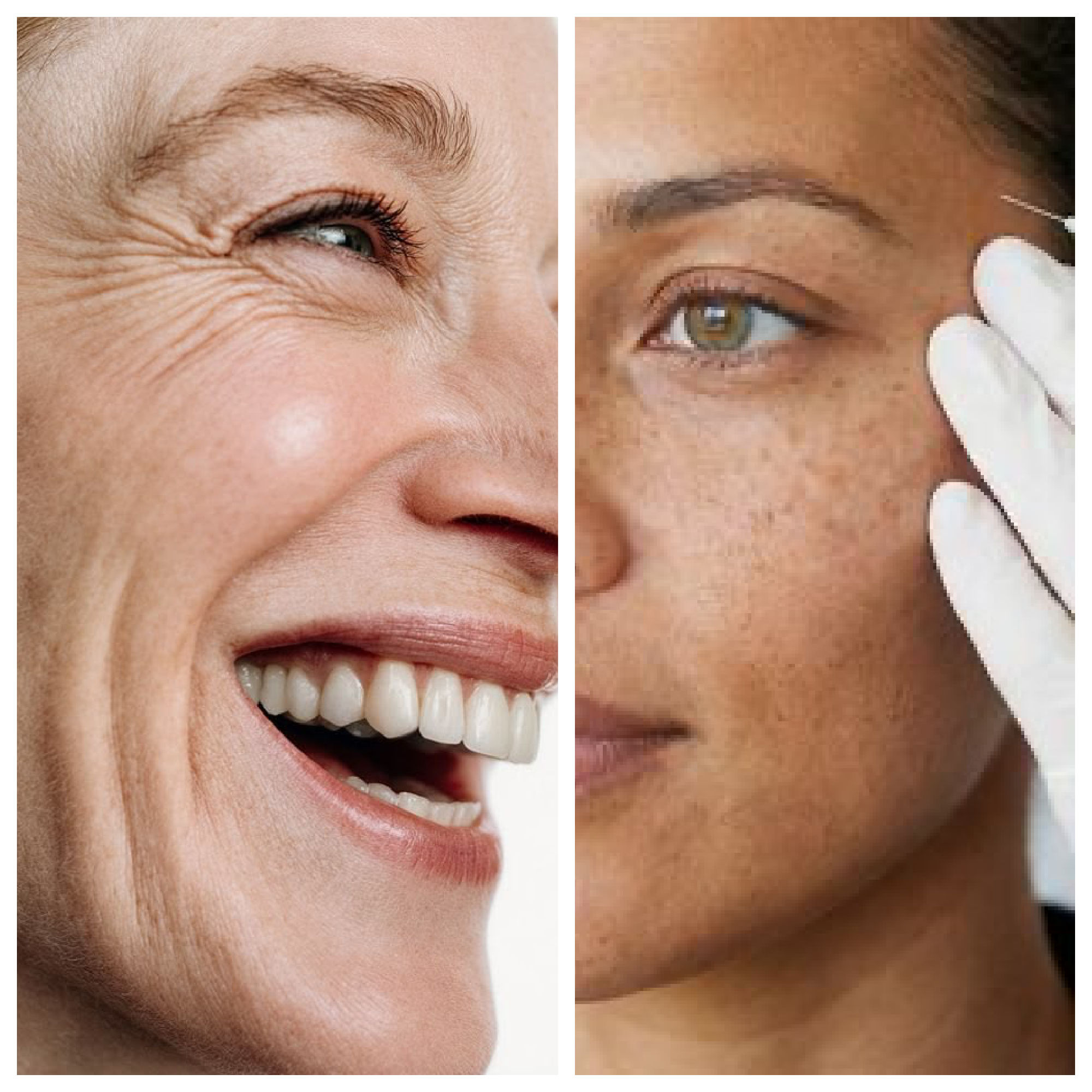skin laxity procedures