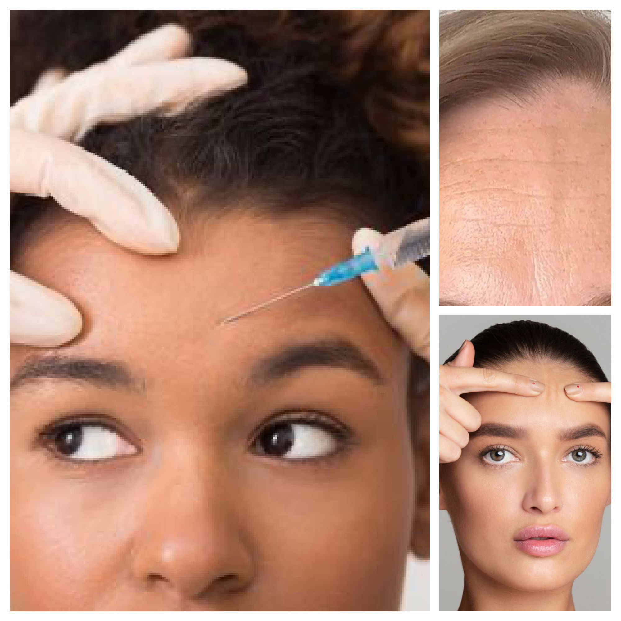 hyaluronic acid treatments