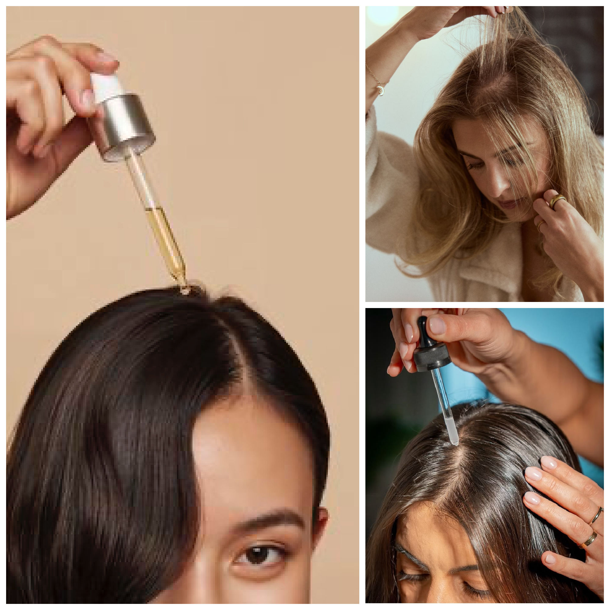 minoxidil solutions for hair growth