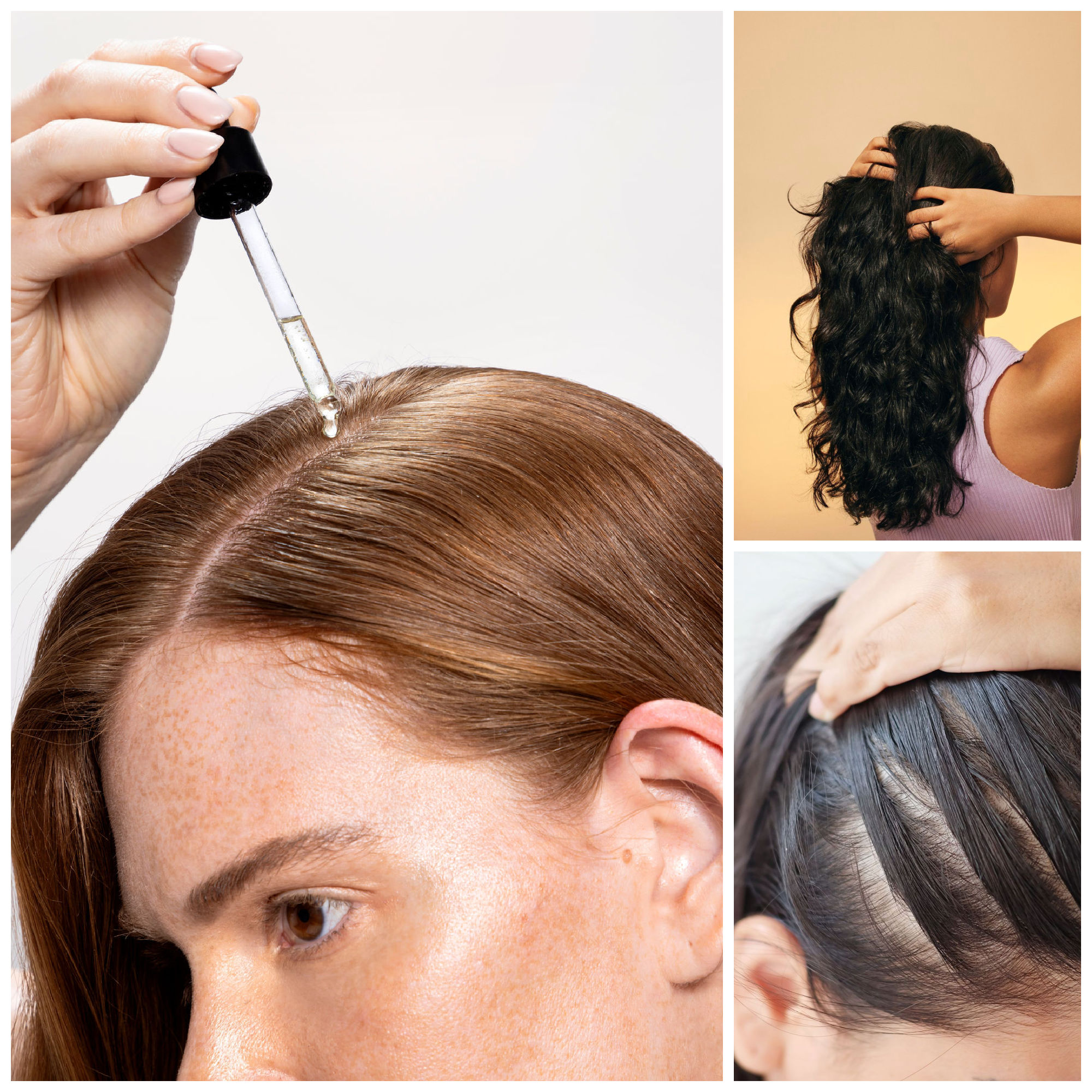 minoxidil solutions for hair growth