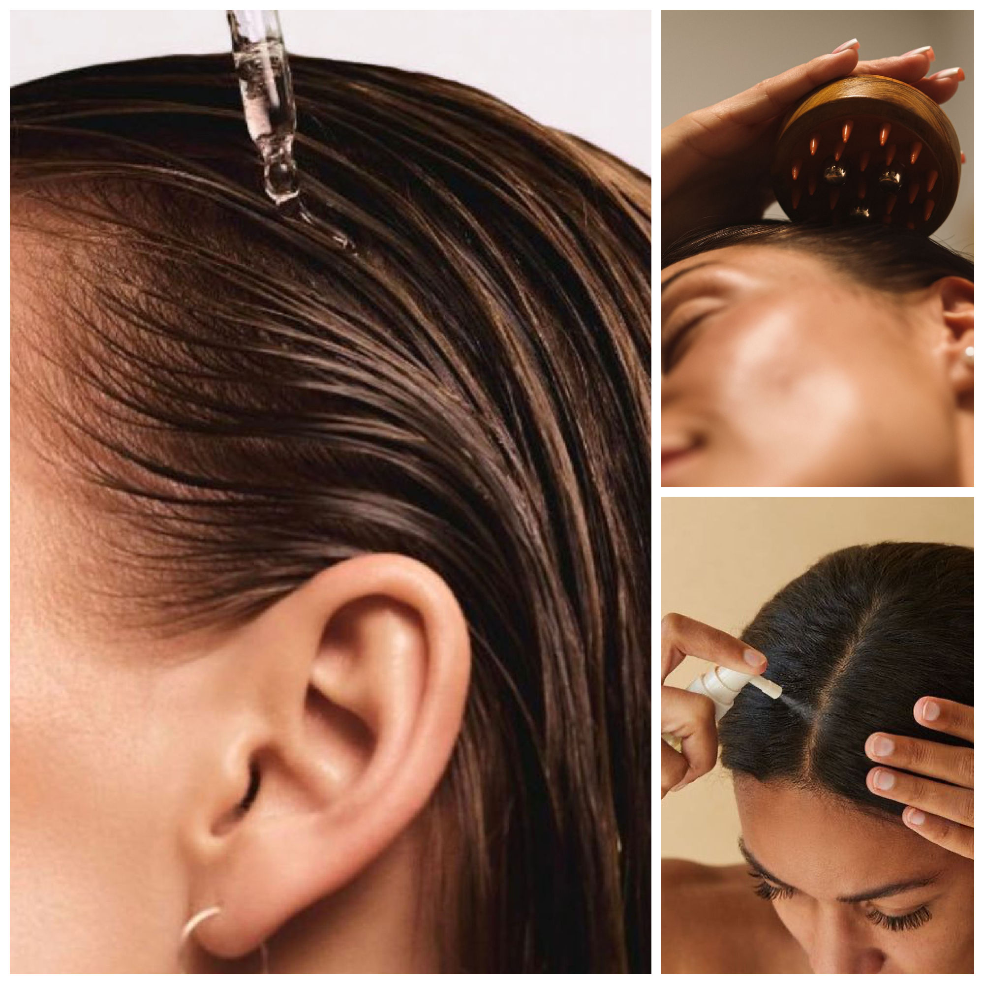 minoxidil solutions for hair growth