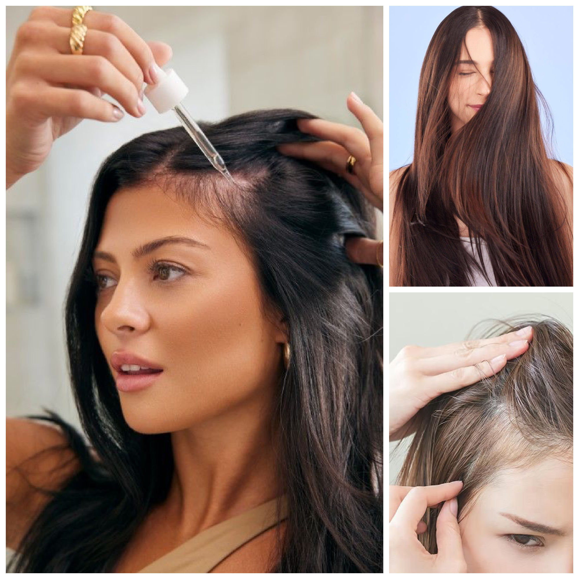 minoxidil solutions for hair growth